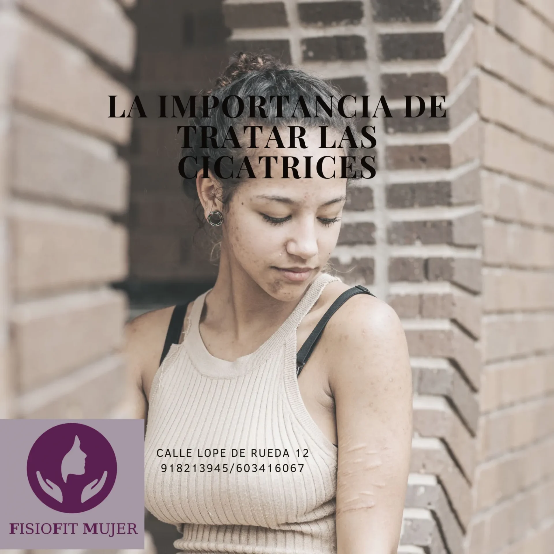 LA IMPORTANCIA DE TRATAR LAS CICATRICES Clínica de Fisioterapia Mujer tratar cicatrices