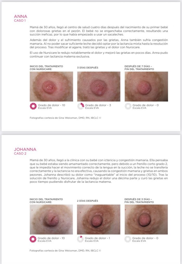 IMG_5368.jpg Fisioterapia para la Mujer - NURSICARE (GRIETAS PECHO)
