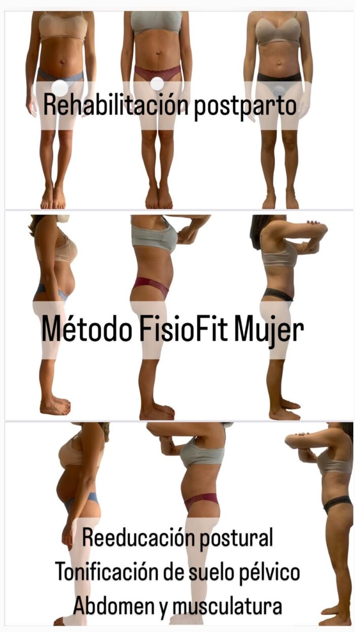 antes y despues Fisioterapia para la Mujer - Bono 5 Sesiones Rehabilitación Suelo Pélvico & Postparto