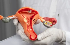 prolapso uterino tratamiento