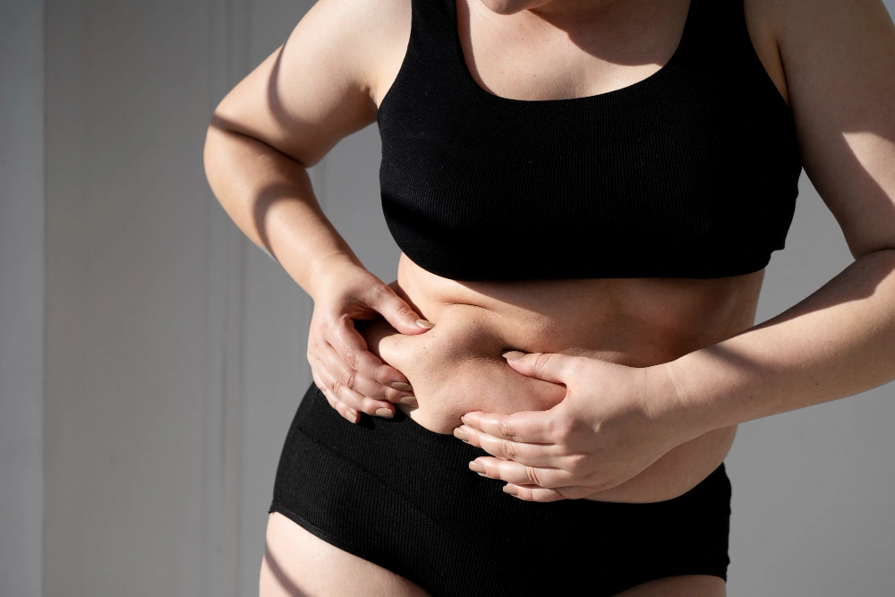 ¿Se puede eliminar la flacidez abdominal? Clínica de Fisioterapia Mujer flacidez abdominal se puede eliminar