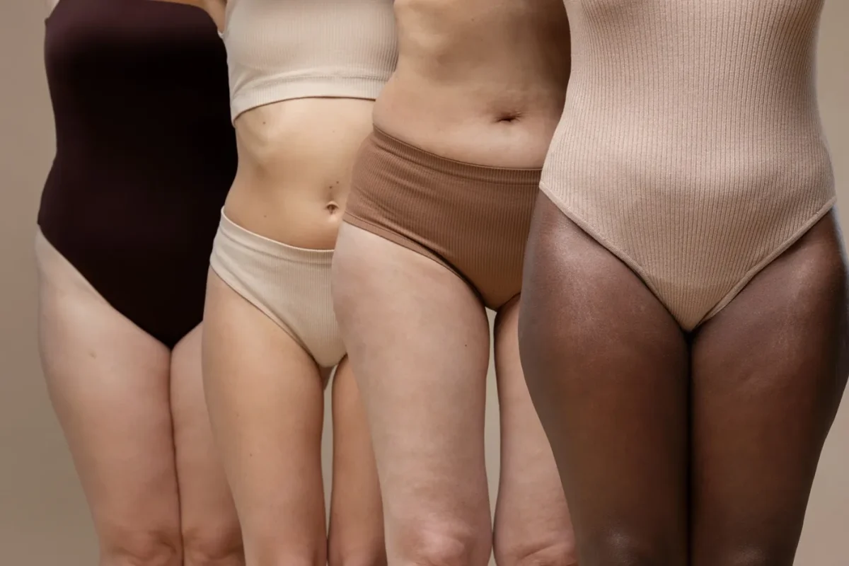 la celulitis y la flacidez